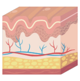 Dermis
